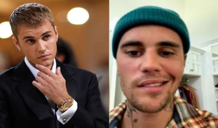Justin Bieber reveals facial paralysis