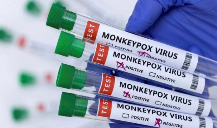 united-states-has-declared-monkeypox-a-public-health-emergency